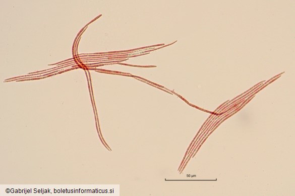 Epichloë typhina