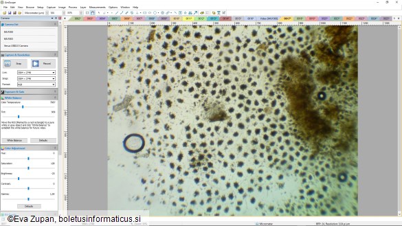 Cheirospora botryospora