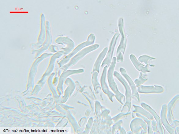 Orbilia pseudoaristata