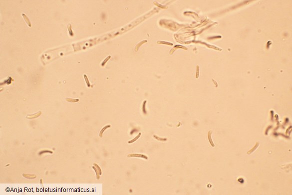 Diatrypella favacea