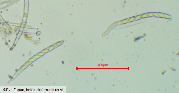 Ciboria coryli