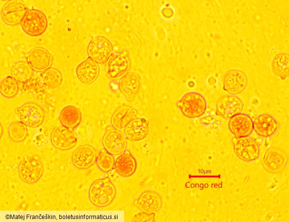 Naematelia encephala