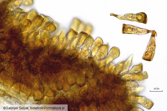 Puccinia striiformis