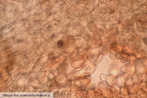 Arcyria cinerea