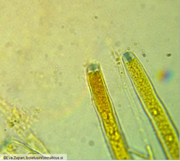 Ciboria coryli