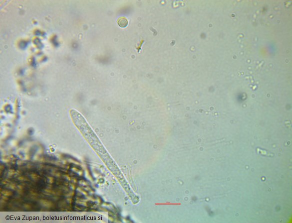 Pyrenopeziza petiolaris