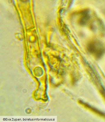 Ciboria coryli