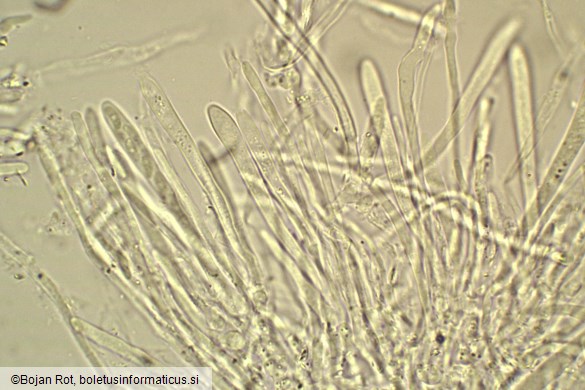 Tapesia lividofusca