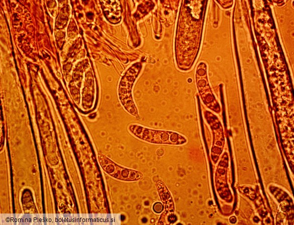 Rutstroemia alnobetulae