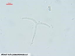 Orbilia pseudoaristata