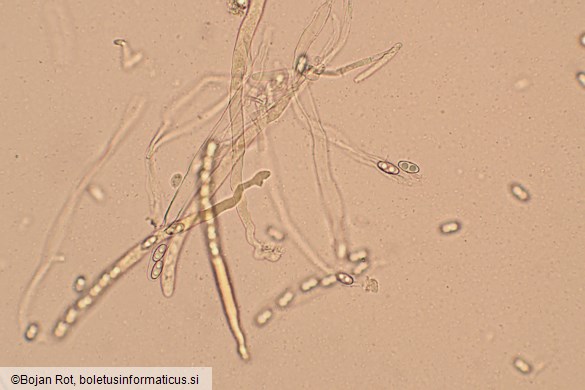 Otidea concinna