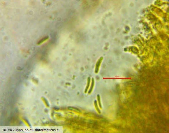 Calycina vulgaris