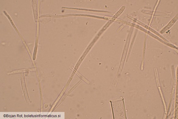 Rutstroemia firma