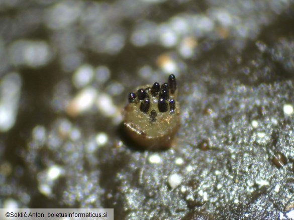Ascobolus immersus