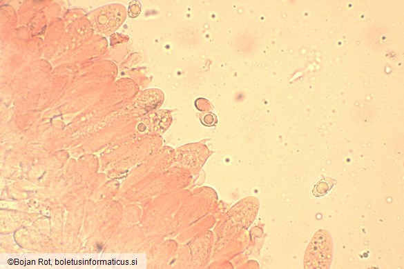 Melanoleuca luteolosperma