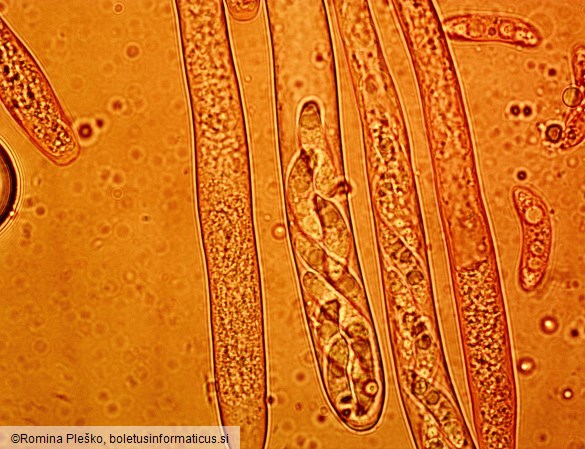 Rutstroemia alnobetulae