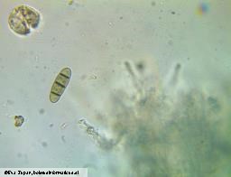 Hysterium angustatum
