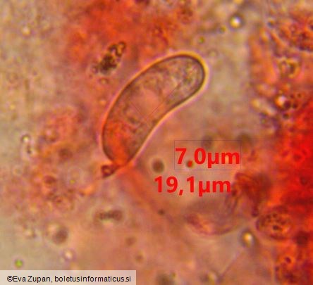 Vuilleminia comedens