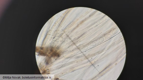 Pachyella violaceonigra