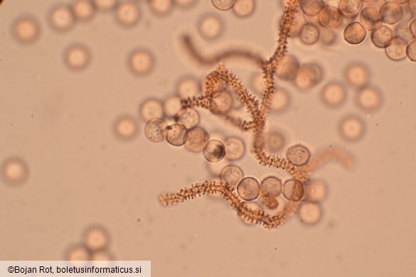 Arcyria cinerea