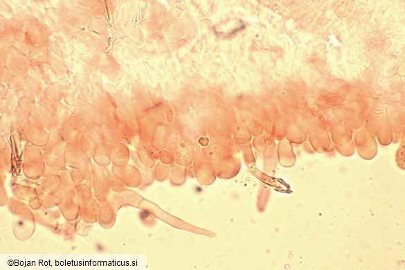 Melanoleuca luteolosperma
