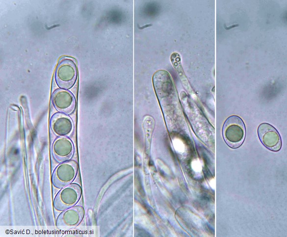 Octospora lilacina