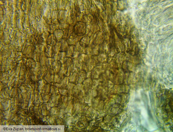 Fuscolachnum pteridis