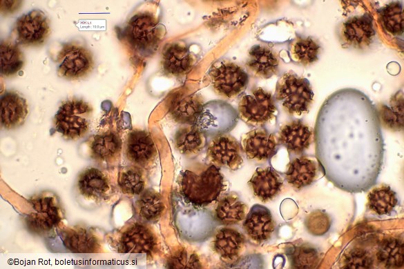 Scleroderma bovista