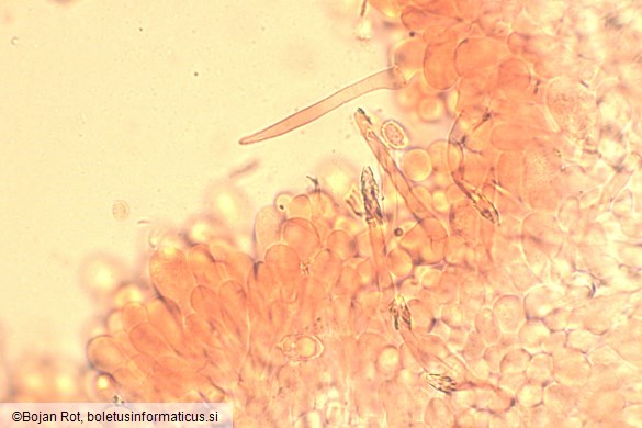 Melanoleuca luteolosperma