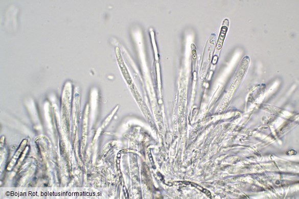 Tapesia lividofusca