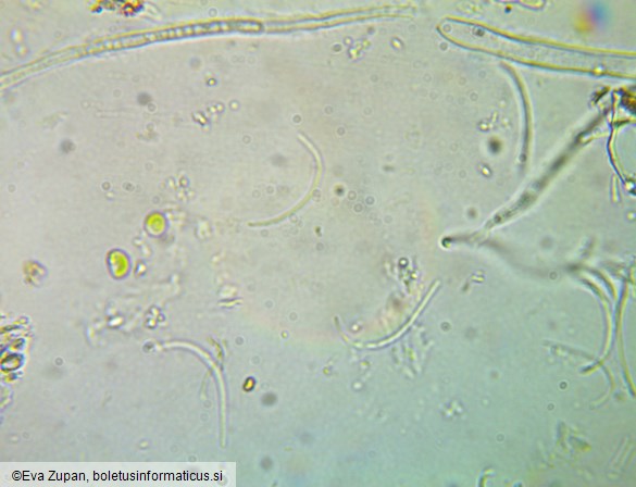 Tryblidiopsis pinastri
