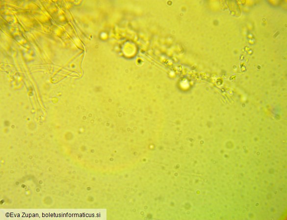 Trechispora mollusca