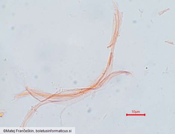 Cordyceps militaris