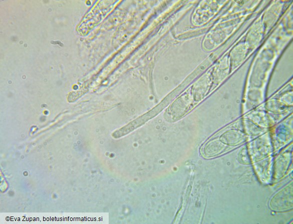 Ciboria coryli