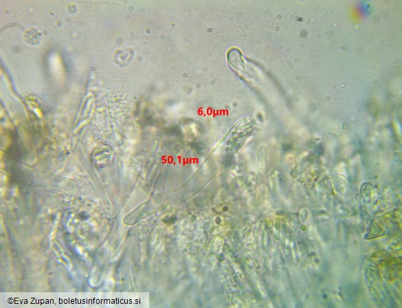 Calycina vulgaris