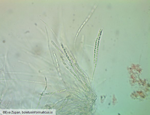 Phomatospora berkeleyi