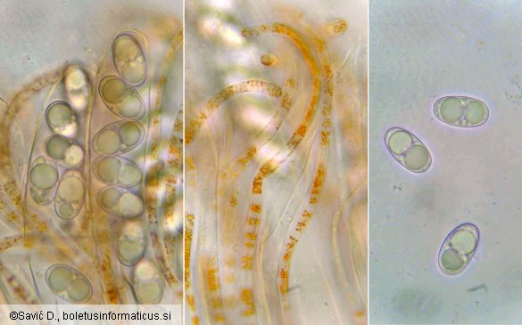 Octospora humosa