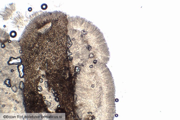 Tapesia lividofusca