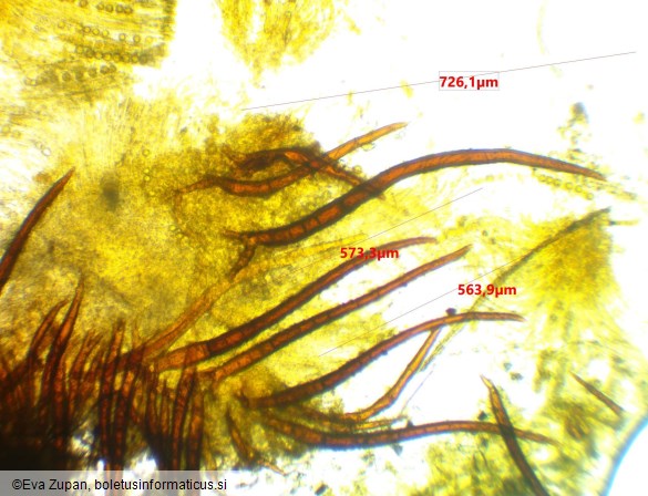 Scutellinia trechispora