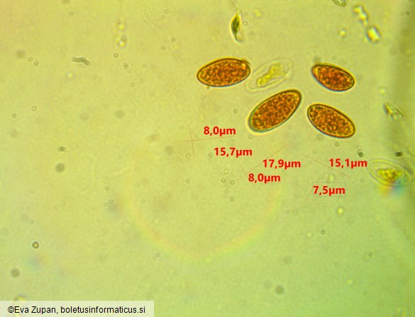 Ciboria coryli
