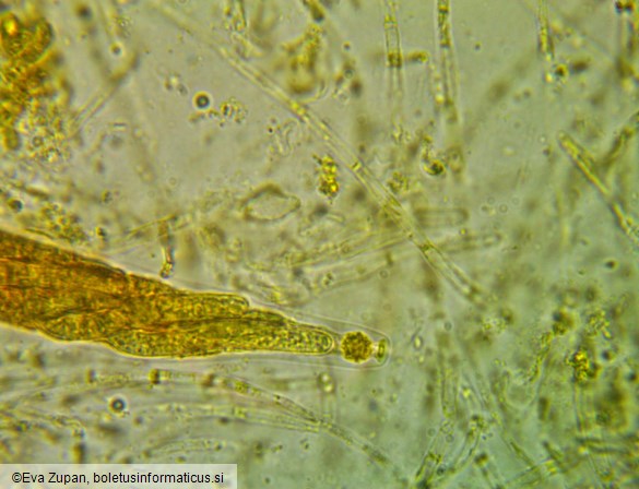 Lasiosphaeria ovina
