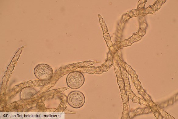 Trichia varia
