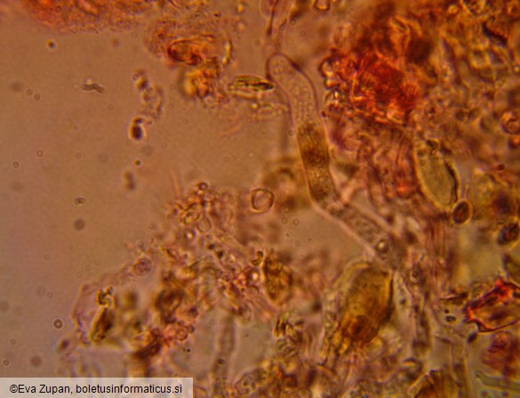Vuilleminia coryli