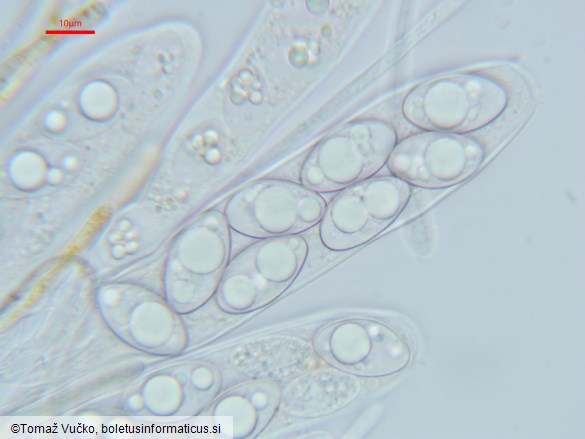 Octospora leucoloma