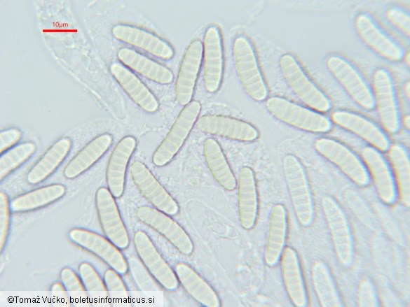 Thyronectria aurigera
