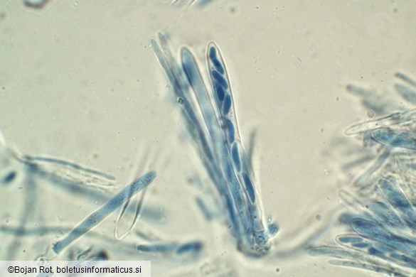 Tapesia lividofusca