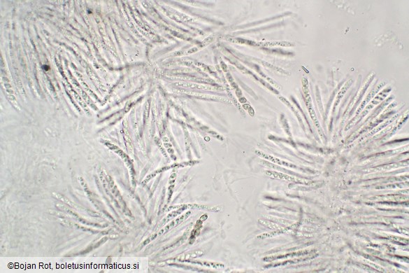 Cosmospora arxii