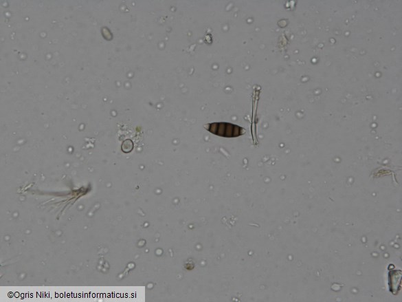 Seiridium cardinale