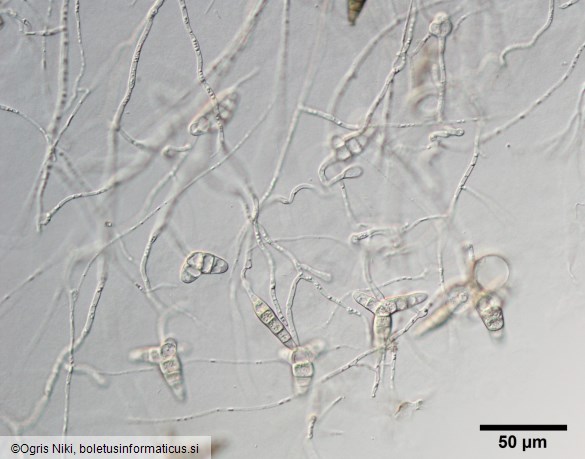 <i>Asterosporium asterospermum</i>