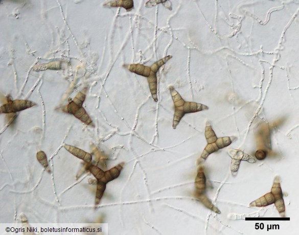 <i>Asterosporium asterospermum</i>